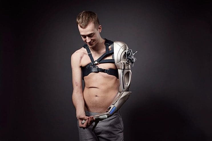 Este gamer con el brazo amputado recibirá la prótesis más alucinante que hay 01
