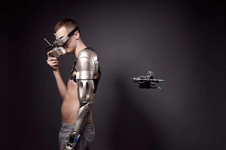 Este gamer con el brazo amputado recibirá la prótesis más alucinante que hay 02