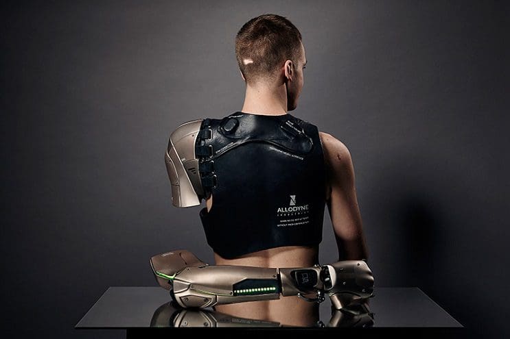 Este gamer con el brazo amputado recibirá la prótesis más alucinante que hay 04