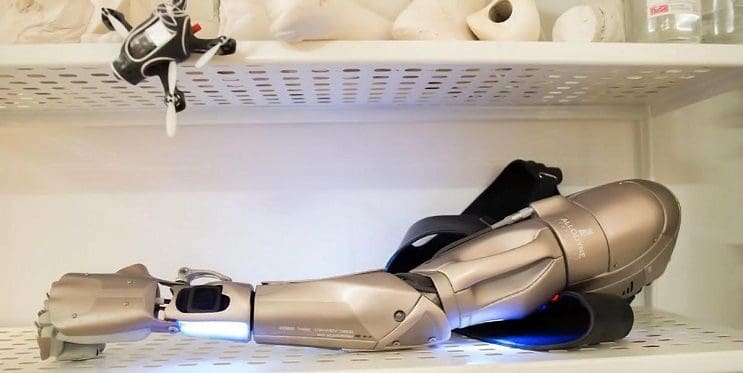 Este gamer con el brazo amputado recibirá la prótesis más alucinante que hay 07