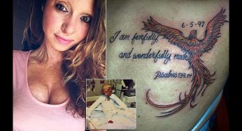 Niña que pasó por un terrible accidente sorprende a todos con impresionante cambio