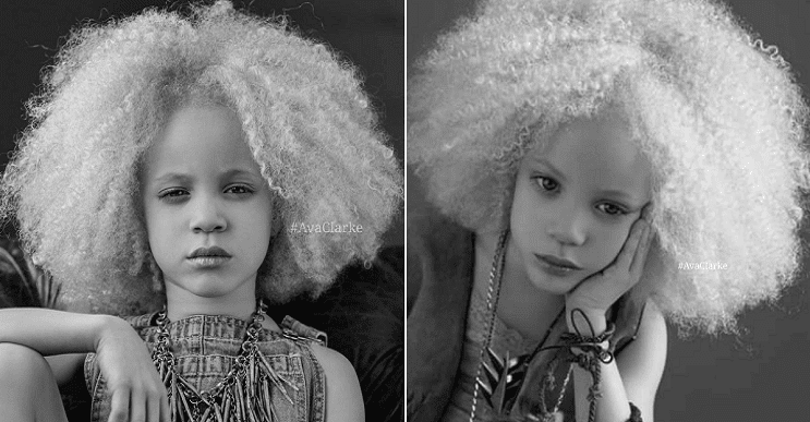 Ava Clarke: la niña albina de raza negra que cautiva en el mundo de la moda  