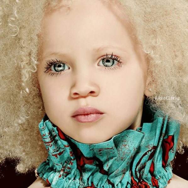 Ava Clarke la niña albina de raza negra que cautiva en el mundo de la moda 01