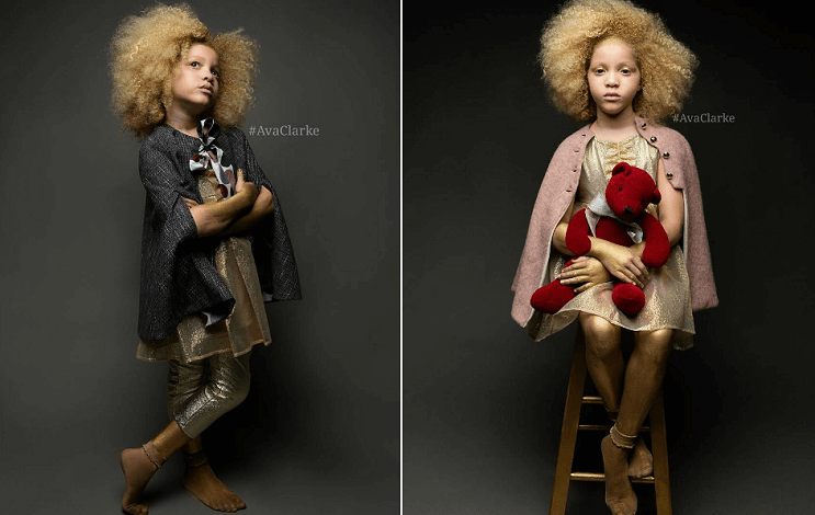 Ava Clarke la niña albina de raza negra que cautiva en el mundo de la moda 03