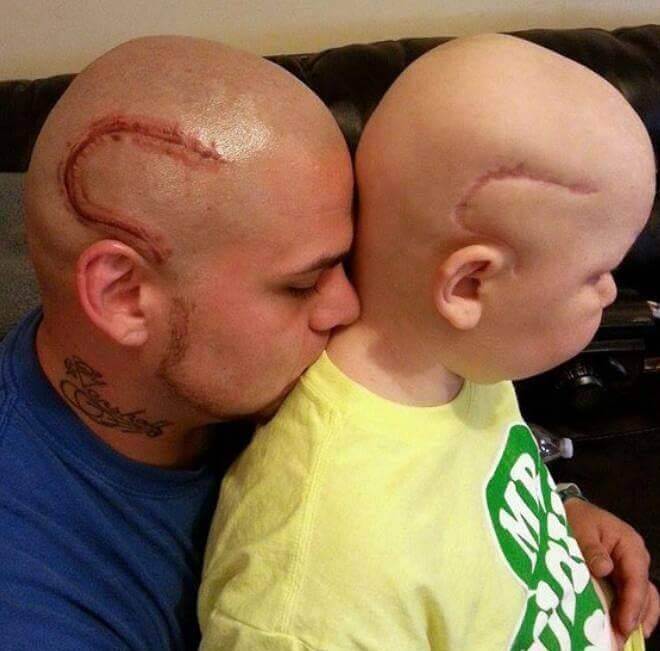 Este padre se tatuó una cicatriz como la que tiene su hijo en la cabeza para apoyarlo en un difícil momento 01