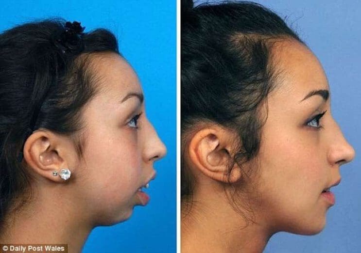 Mujer luce irreconocible después de una operación de mandíbula 3
