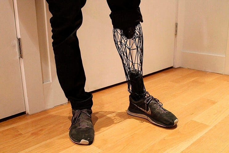 el-diseno-de-esta-pierna-de-titanio-lleva-a-las-protesis-un-paso-mas-alla-por-su-efectividad-y-forma-1