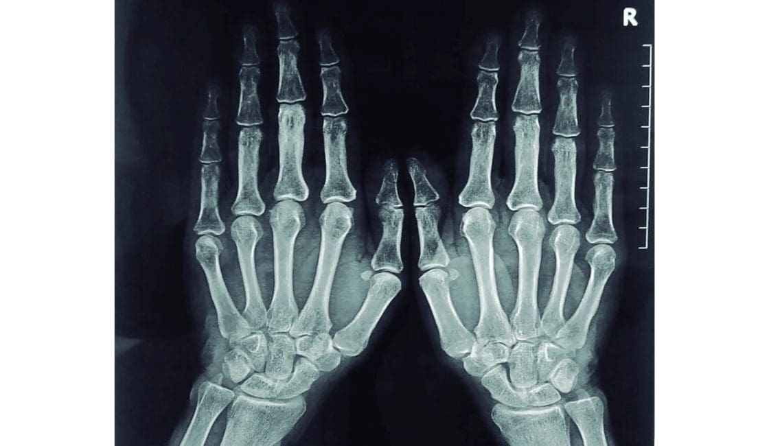 los objetos tecnológicos antiguos y modernos los objetos tecnológicos antiguos y modernos